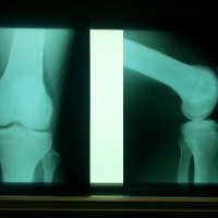 Knie