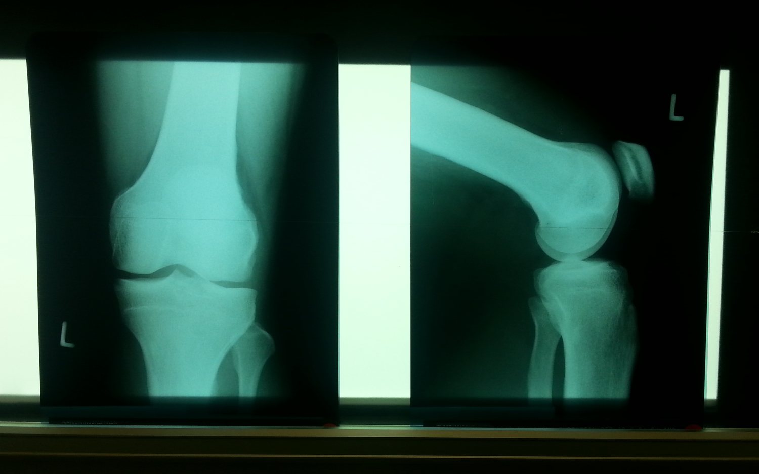Knie